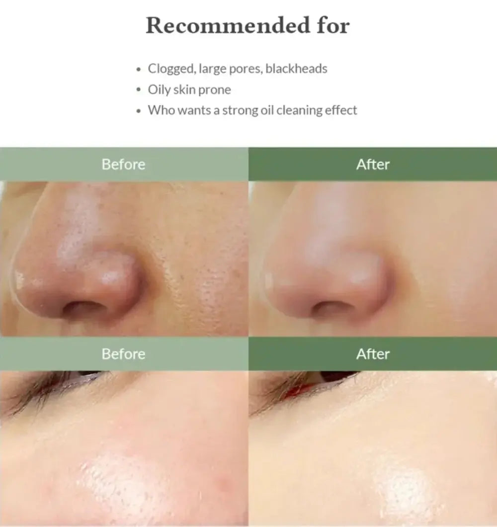 Dr. Althea Premium Quick Step Sebum Cleanser @ Casa de Ella Mexico | limpiador facial premium diseñado para remover impurezas.