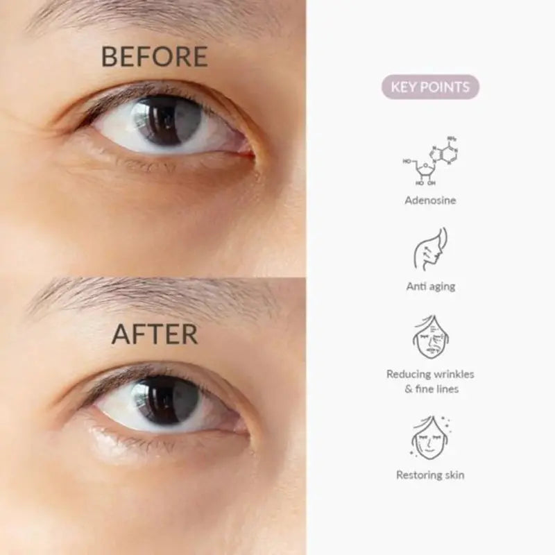 Dr. Althea To Be Youthful Eye Serum @ Casa de Ella Mexico | Suero Coreano para los ojos - foto de Antes & Depues