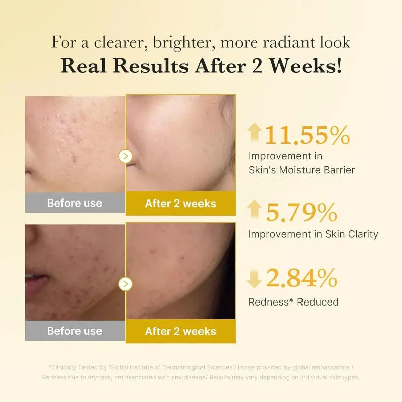 Medicube Kojic Acid Turmeric Resurfacing Toner at Casa de Ella Mexico