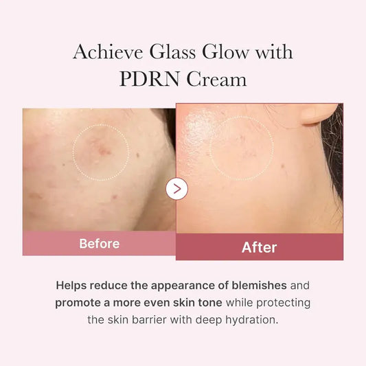 Medicube PDRN Pink Hyaluronic Moisturizing Cream @ Casa de Ella Mexico