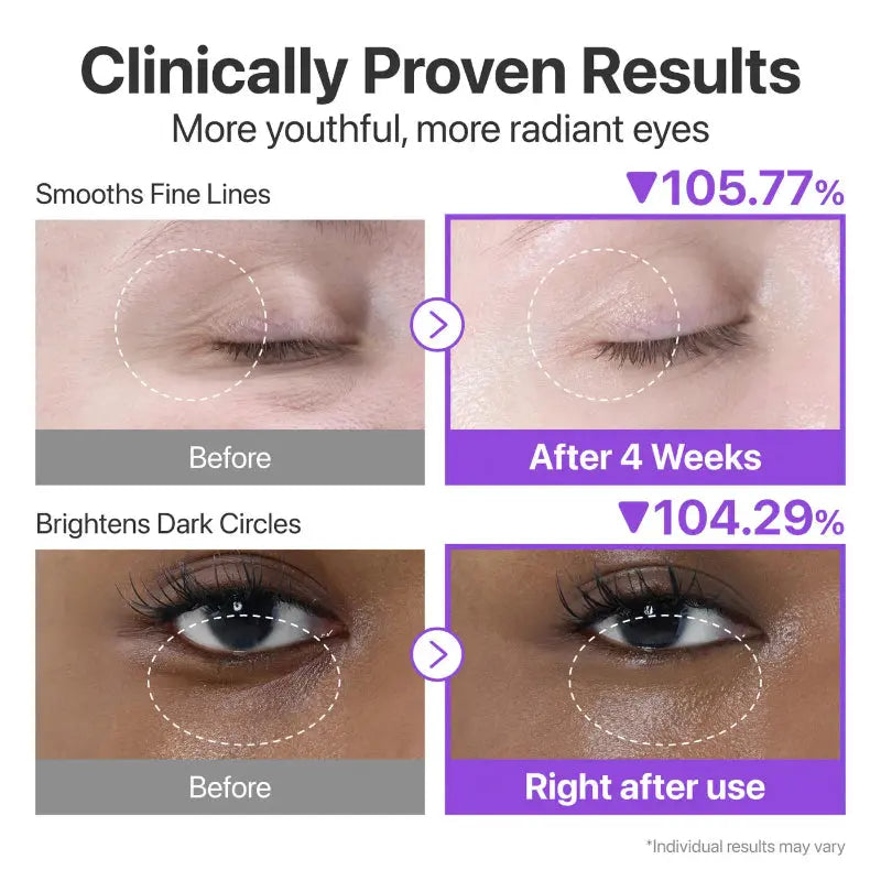 Numbuzin No.9 NAD+ Retinol Volumetox Eye Cream at Casa de Ela Mexico